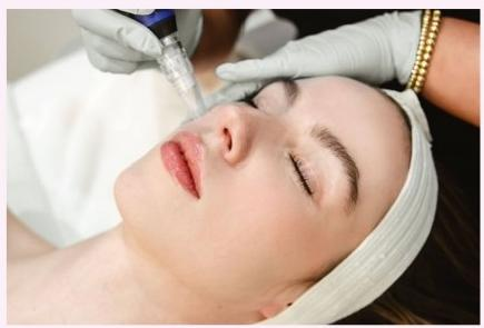 PRO MICRONEEDLING $158